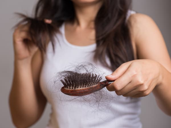 Mounjaro hair loss guide — tirzepatide hair thinning telogen effluvium prevention tips UK Mymetabolism