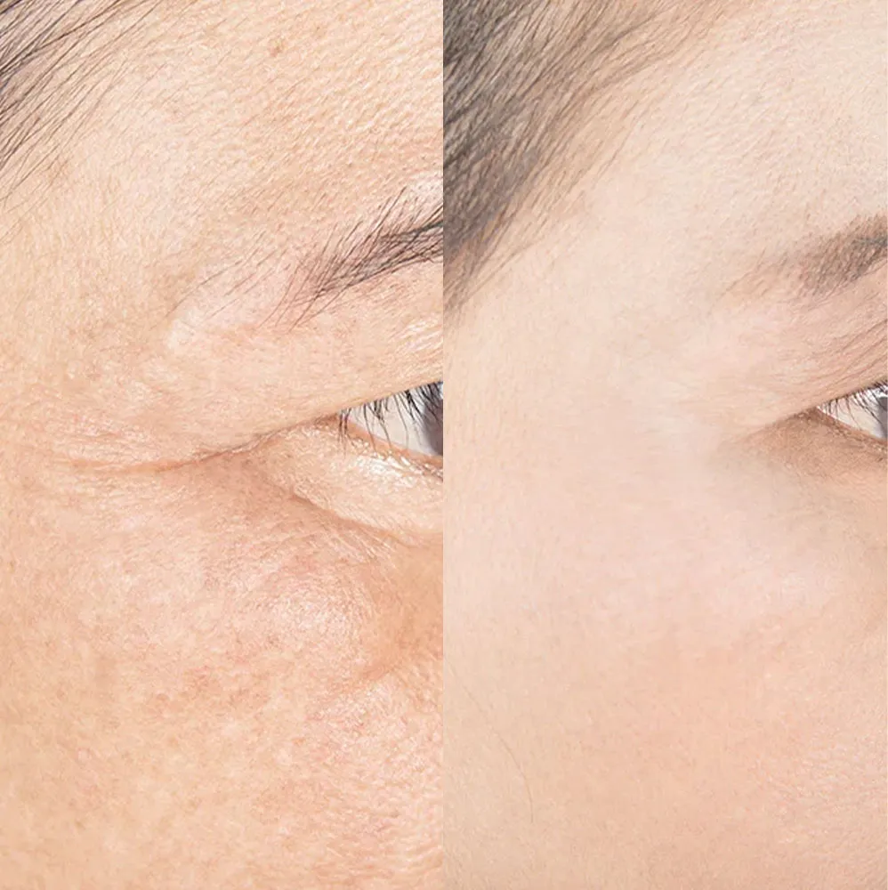Glow peptides UK skin rejuvenation collagen GHK-Cu evidence 2026
